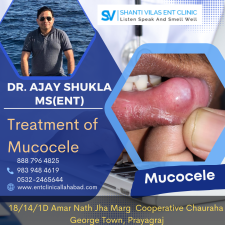Treatment of Mucocele Dr. Ajay Shukla MS(ENT)